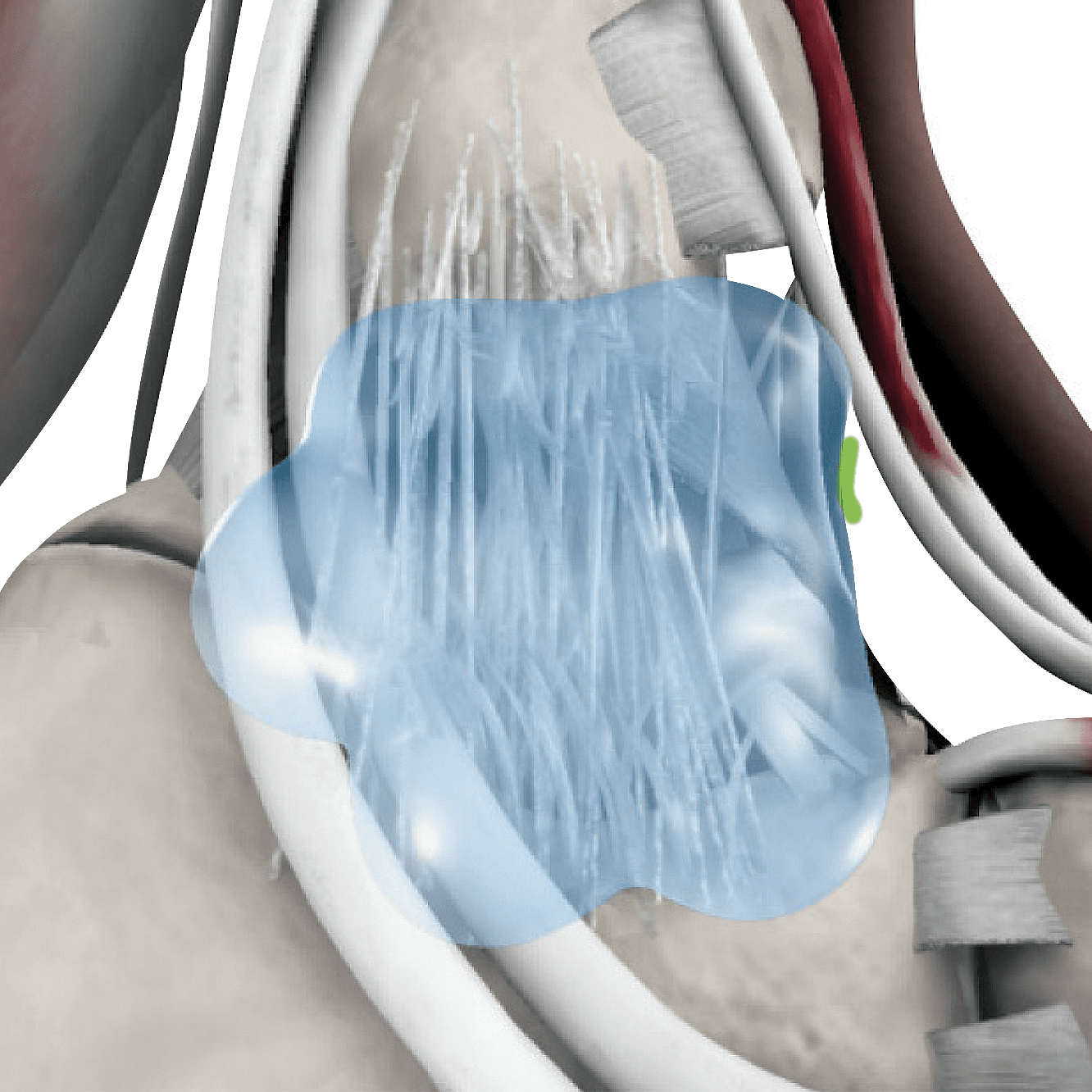 During treatment