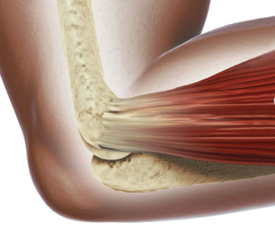 Infographic of a healed tendon