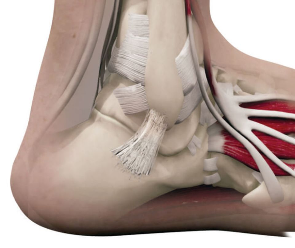 Infographic of a healed ankle