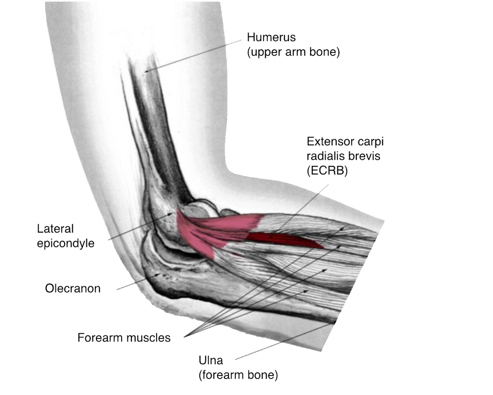 Drawing of tendon and bone in an elbow